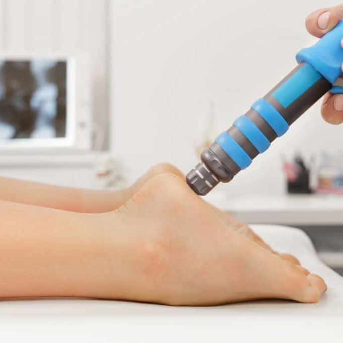 Extracorporeal Shockwave Therapy ESWT.Effective non-surgical treatment.Physical therapy for plantarfascitis with shock waves.Pain relief, normalization and regeneration,stimulation of healing process.